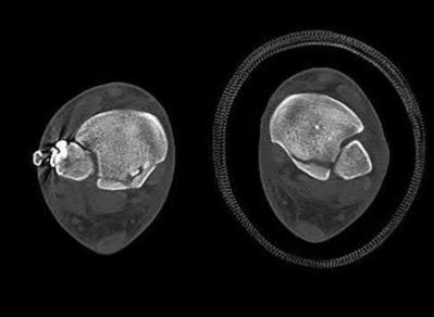 Illustration 53 for OrthoCash: Trauma MCQs & Cases for a yearold woman