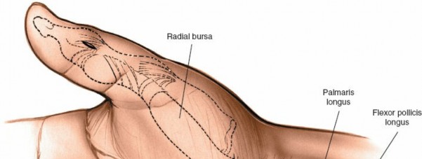 Illustration 3 for Surgical Secrets: Anatomy of the Deep Palmar Space Revealed