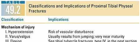 Illustration 21 for Master Pediatric Femoral Shaft & Knee Fractures: Interactive Module