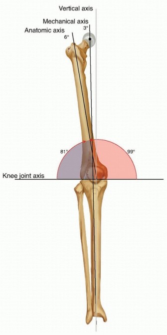 Illustration 2 for Repairing Distal Femur Fractures: Open Reduction & Internal Fixation