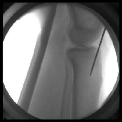 Illustration 3 for OrthoCash: Trauma MCQs & Cases for a yearold woman