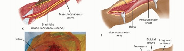 Illustration 11 for Surgical Approaches to Shoulder & Elbow: Pearls and Pitfalls
