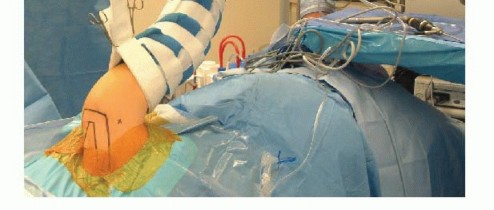 Illustration 12 for Regain Stability: Arthroscopy for Anterior Instability & the Inferior Glenohumeral Ligament