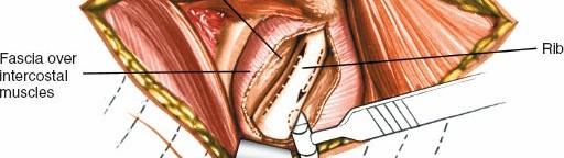Illustration 297 for Approach to the Lumbar Spine: Mastering Techniques & Anatomy