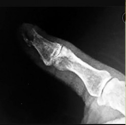 صورة طبية: دليل الأستاذ الدكتور محمد هطيف الشامل لأمراض وإصابات اليد والمعصم في صنعاء