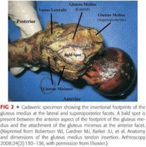Illustration 14 for Periarticular Arthroscopy: Addressing Medius & Minimus Tears