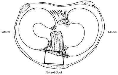 Illustration 4 for OrthoCash: Trauma MCQs & Cases for a yearold woman