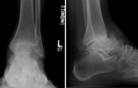 Illustration 7 for First Metatarsal Surgery: Expert Solutions for Foot & Ankle Pain