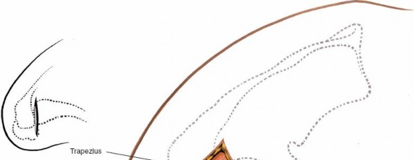 Illustration 155 for Essential Guide: Mastering Every Approach to the Shoulder