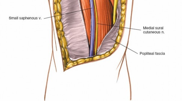 Illustration 185 for Mastering Knee Approaches: Spotlight on Superficial Medial Ligament