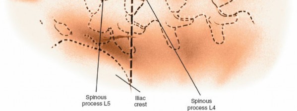 Illustration 7 for Approach to the Lumbar Spine: Mastering Techniques & Anatomy