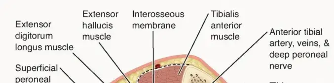 صورة توضيحية لـ متلازمة الحيز الجهدي المزمن: دليل شامل للمرضى مع الأستاذ الدكتور محمد هطيف