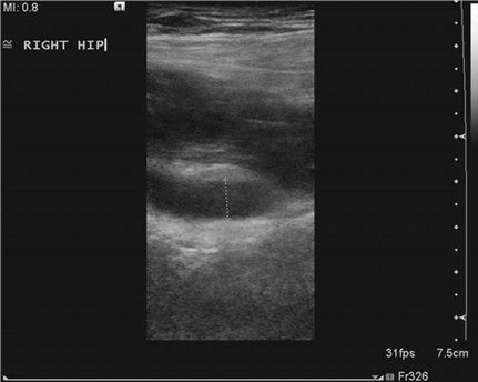 Illustration 19 for Master Hands and Paediatric Orthopaedics: Diagnose & Treat