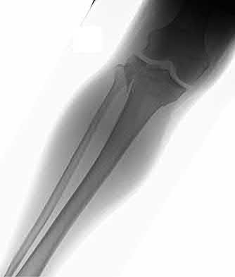 Illustration 206 for OrthoCash: Trauma MCQs & Cases for a yearold woman