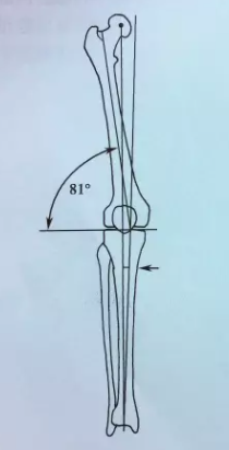 股骨远端骨折挑战重重？c ct mridoppler 精准评估，助您掌握关键固定技巧，确保手术成功与膝关节功能！