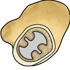 Illustration 62 for Collum Femoris Preserving: Achieve Better Primary Hip Outcomes