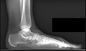 Orthopedic Surgery Mock Exam - Set B29D06