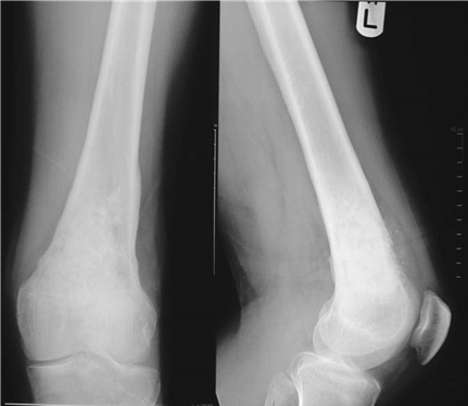 Illustration 30 for Ace FRCS Orthopaedics: Oxford University Press Adult Pathology Viva