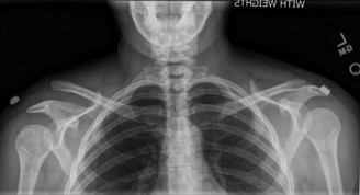 Illustration 72 for Acad Orthop Surg Challenge: Diagnose Shoulder Pain Case 1