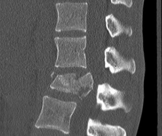 Illustration 40 for Master Orthopedic Spine Cases: Sharpen Your Diagnostic Skills