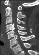 Orthopedic Spine: Every crucial question of clinical practice.