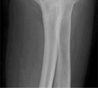 Illustration 51 for Solve Shoulder & Elbow Cases: When a Patient Presents to Clinic