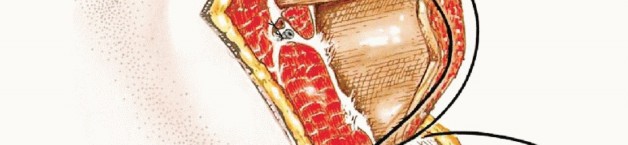 Illustration 16 for Below-Knee Amputation: Maximize Your Below-Knee Recovery & Function