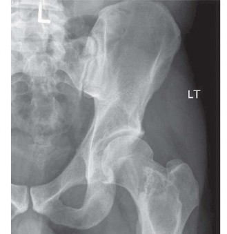 Illustration 3 for Mastering Oncology Cases: Multiple Myeloma & Bone Scan Nuances