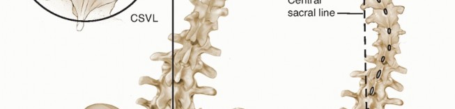 Illustration 12 for Adult Scoliosis: Uncover Causes & Find Lasting Back Pain Relief