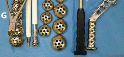 Illustration 13 for Birmingham Hip Resurfacing Designer's Technique for Active Lives