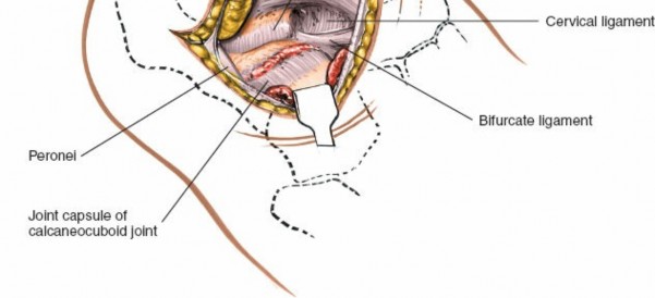 Illustration 111 for Optimized Approaches to the Dorsum of the Foot & Ankle