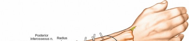 Illustration 5 for Key Approaches for External Fixation: Humerus, Radius, Ulna, Wrist