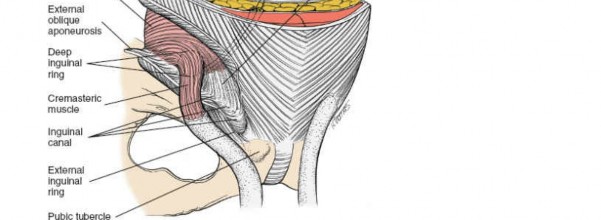 Illustration 99 for Pelvis & Acetabulum Approaches: Unlocking the Posterior Superior Iliac