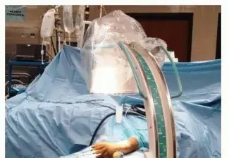 كسور الكعبرة البعيدة المعقدة: دليل شامل لصفائح الجسر العلاجية - مع الدكتور محمد هطيف