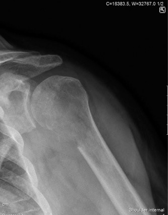 Solving Oncology Cases: Metastatic Bone Diagnosis