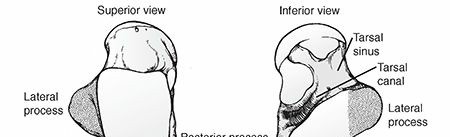 Talus Fractures: Understanding the Talus Bone & Recovery