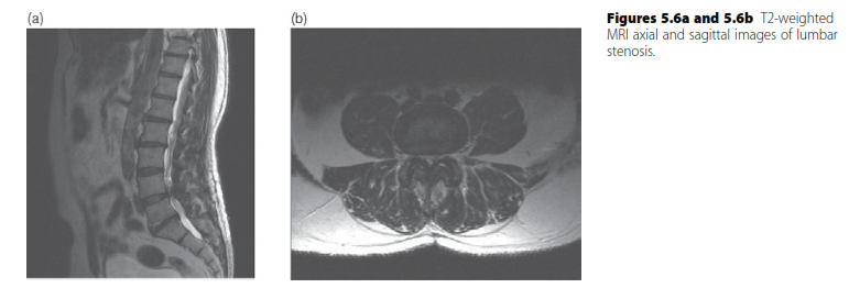 Illustration 3 for Oral Questions Lumbar: Master Spinal Stenosis & Myelopathy