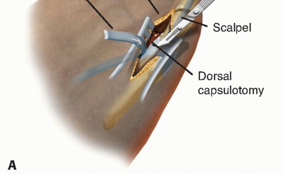 Illustration 25 for Toe Deformity Pain? Rebalance Flexor to Extensor for Relief