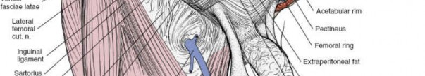 Illustration 35 for Ilioinguinal Approach: Master the Deep Inguinal Ring for Success