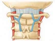 Illustration 26 for Cervical Fusion: The Line is Drawn for Lasting Stability