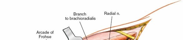 Illustration 61 for Mastering Elbow Approaches: Applied Surgical Anatomy for Precision