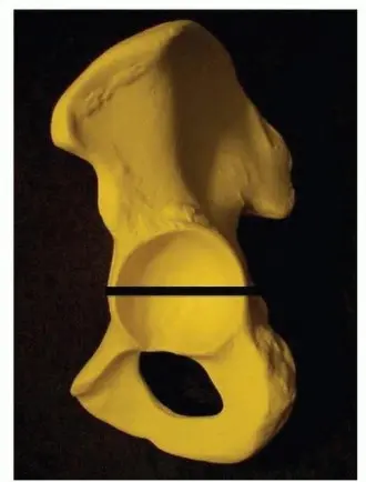 انفصال الحوض: دليل شامل لفهم الانفصال العلوي والسفلي والعلاج المتخصص في صنعاء مع الأستاذ الدكتور محمد هطيف