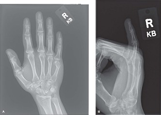 Illustration 12 for Orthopedic Hand Cases: A Patient's Journey, Is a Year Old a Factor?