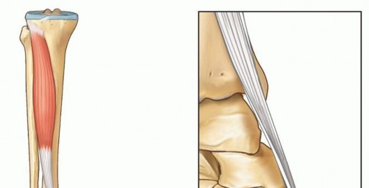 Illustration 3 for Why Anterior Tibialis Muscle Transfer Fixes Clubfoot