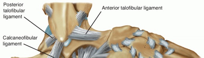 Chronic Ankle Instability: Plantaris Longus Tendon Reconstruction
