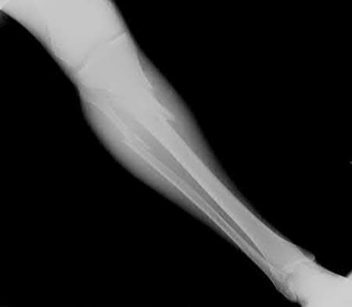 Illustration 170 for OrthoCash: Trauma MCQs & Cases for a yearold woman