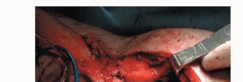 Illustration 18 for Repair & Recover from Collateral Ligament Injuries: Your Guide