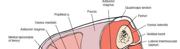 Illustration 124 for Mastering Knee Approaches: Spotlight on Superficial Medial Ligament
