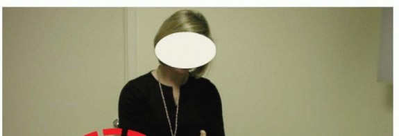 Rectus Femoris Muscle Transfer: Restore Gait & Function