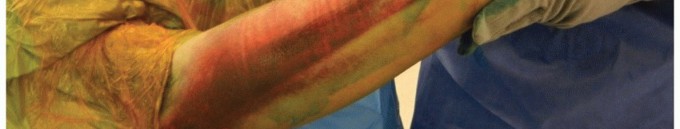 Illustration 14 for Radial Head & Neck Fractures: Mastering ORIF for Best Results